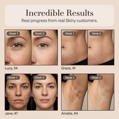 Skiny - Scar & Wrinkle Solution Silicone Stick